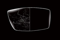 Retinopatie Diabetica Neproliferativa Medoptica