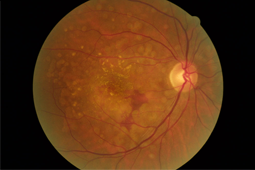 OCT Medoptica